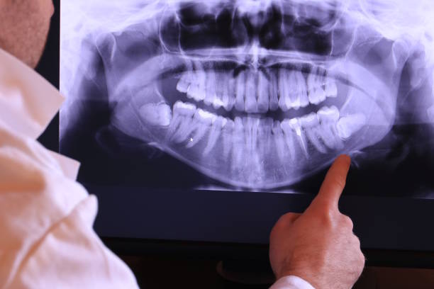 Best Emergency Denture Repair in Port Arthur, TX