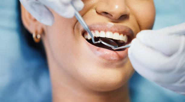 Best Emergency Gum Treatment in Port Arthur, TX
