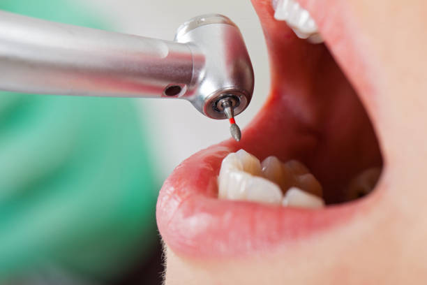 Best Emergency TMJ Treatment in Port Arthur, TX